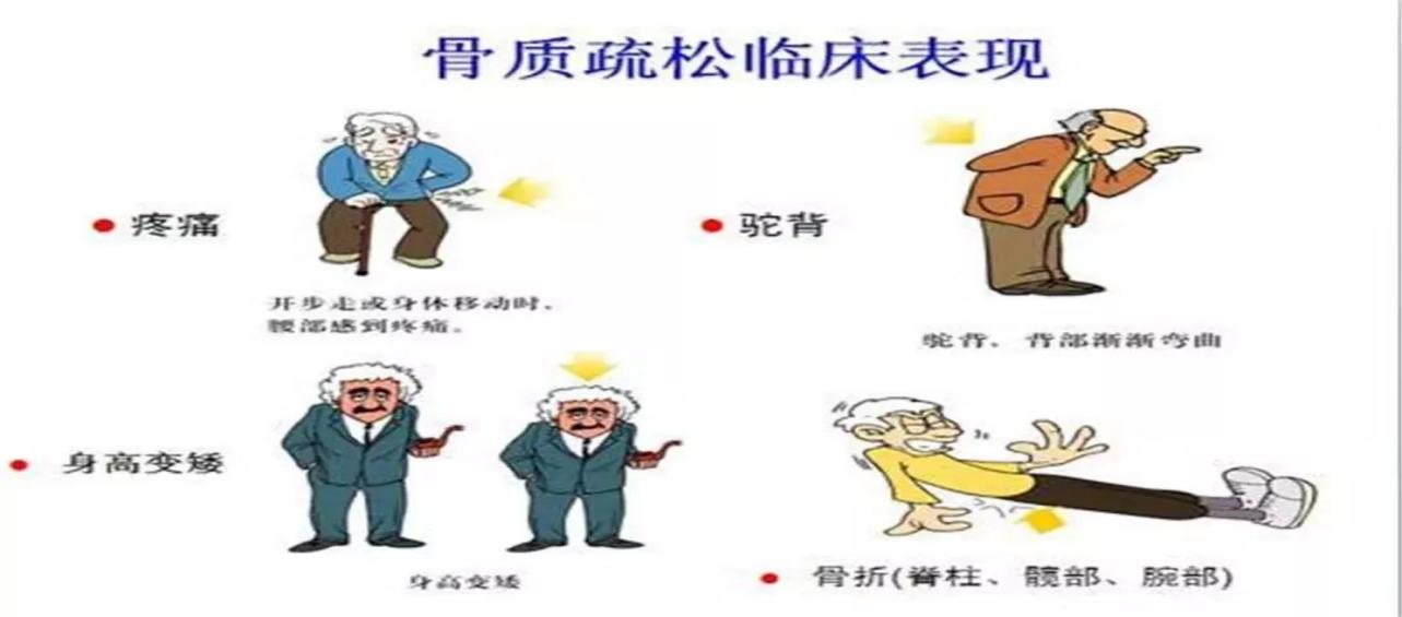 骨质疏松症沉默杀手